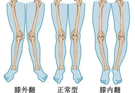 走路外八個性|走路姿势与性格的秘密：解读脚步重、外八及内八字的步伐背后的。